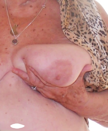 mastitis older woman best pictures